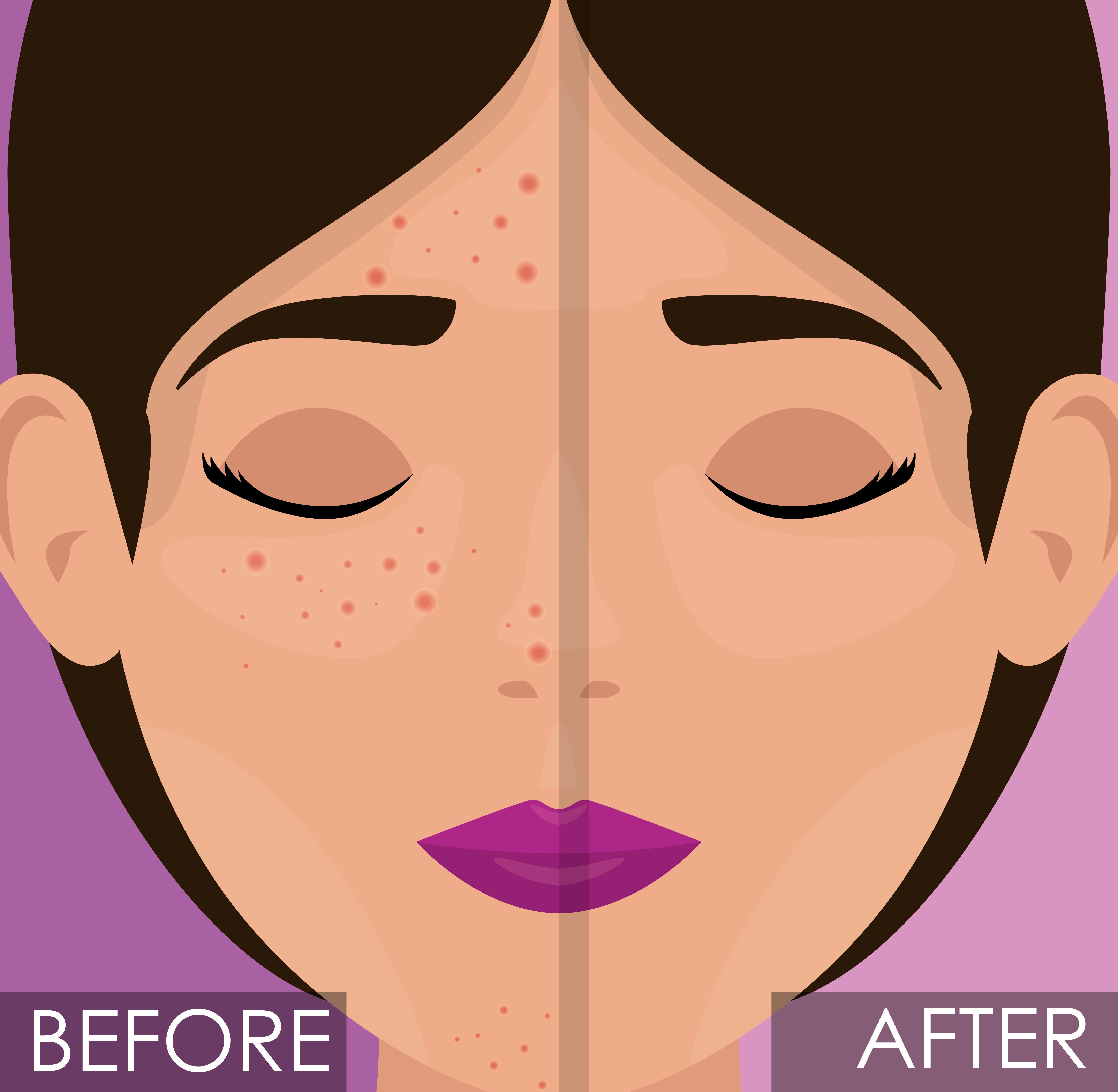 woman before and after skin treatment vector illustration design